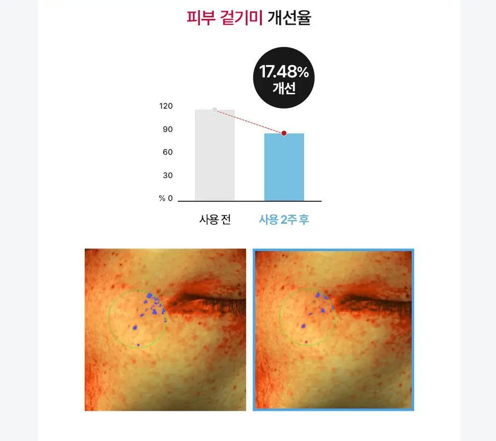[2주 기미/잡티 삭제] 메디톡스 뉴라덤 하이드로 브라이트닝 마스크팩 1매/5매 (하이드로겔) 상세페이지 20